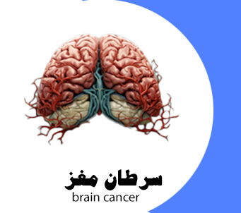 بهترین روش درمان سرطان مغز
